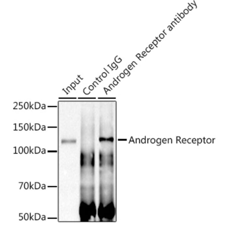 Western Blot - Anti-Androgen Receptor Antibody [ARC0090] (A307312) - Antibodies.com