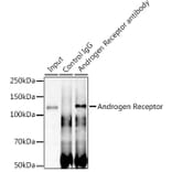 Western Blot - Anti-Androgen Receptor Antibody [ARC0090] (A307312) - Antibodies.com