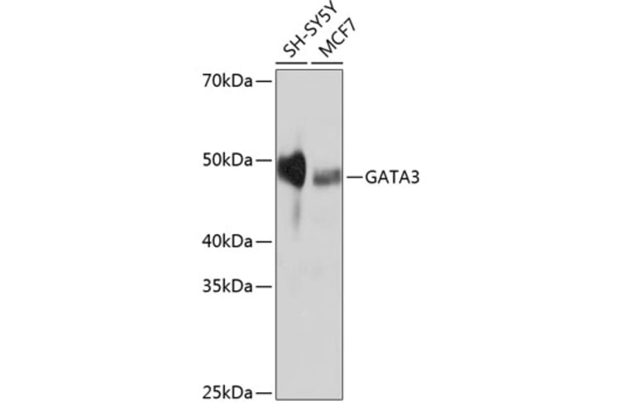 Western Blot - Anti-GATA3 Antibody [ARC0115] (A307313) - Antibodies.com