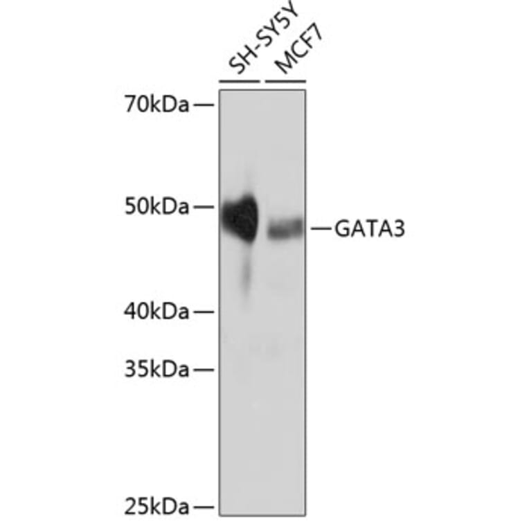 Western Blot - Anti-GATA3 Antibody [ARC0115] (A307313) - Antibodies.com