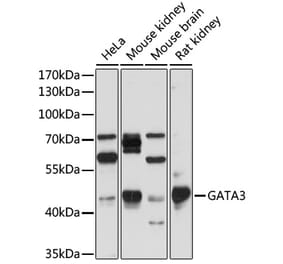 Western Blot - Anti-GATA3 Antibody (A307314) - Antibodies.com
