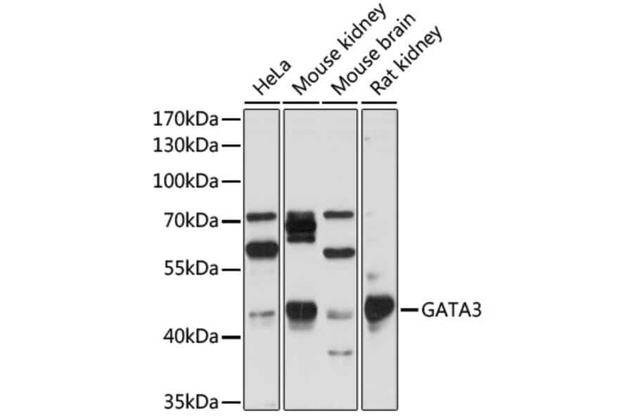 Western Blot - Anti-GATA3 Antibody (A307314) - Antibodies.com