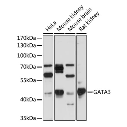 Western Blot - Anti-GATA3 Antibody (A307314) - Antibodies.com