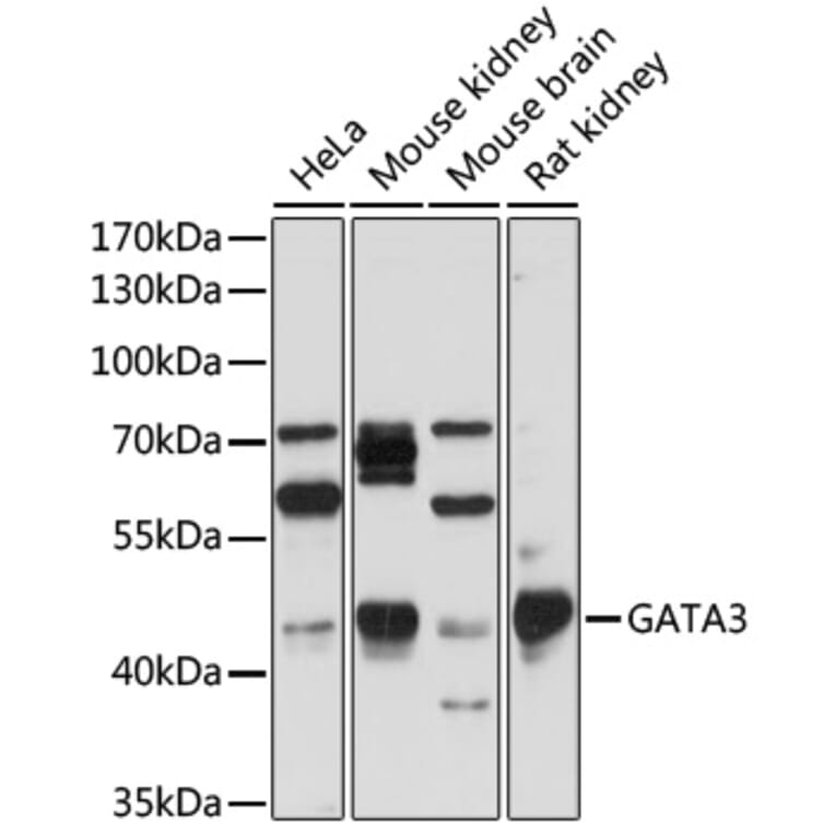 Western Blot - Anti-GATA3 Antibody (A307314) - Antibodies.com
