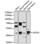 Western Blot - Anti-GATA3 Antibody (A307314) - Antibodies.com
