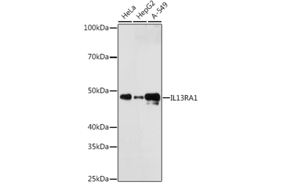 Western Blot - Anti-IL-13 receptor alpha 1 Antibody (A307315) - Antibodies.com