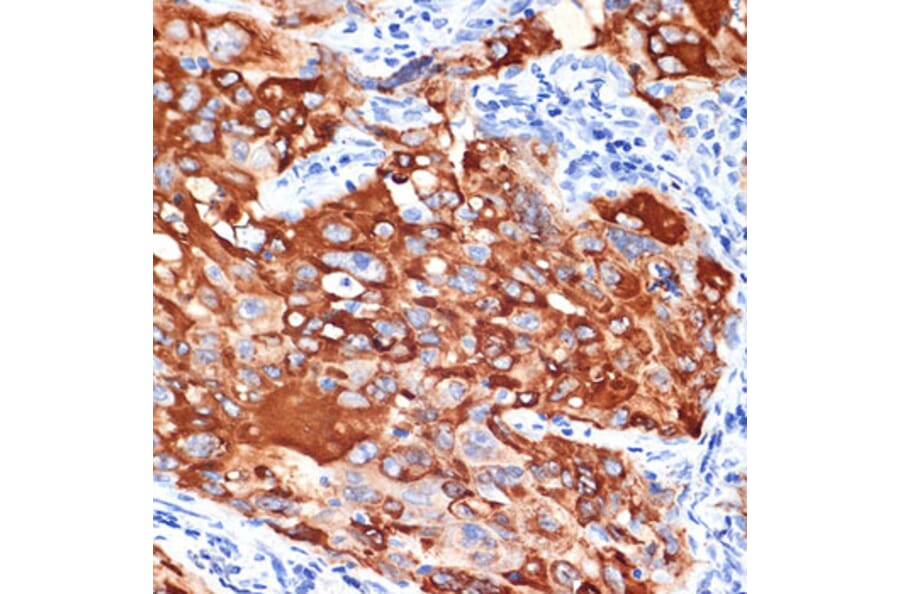 Immunohistochemistry - Anti-IL-13 receptor alpha 1 Antibody (A307315) - Antibodies.com