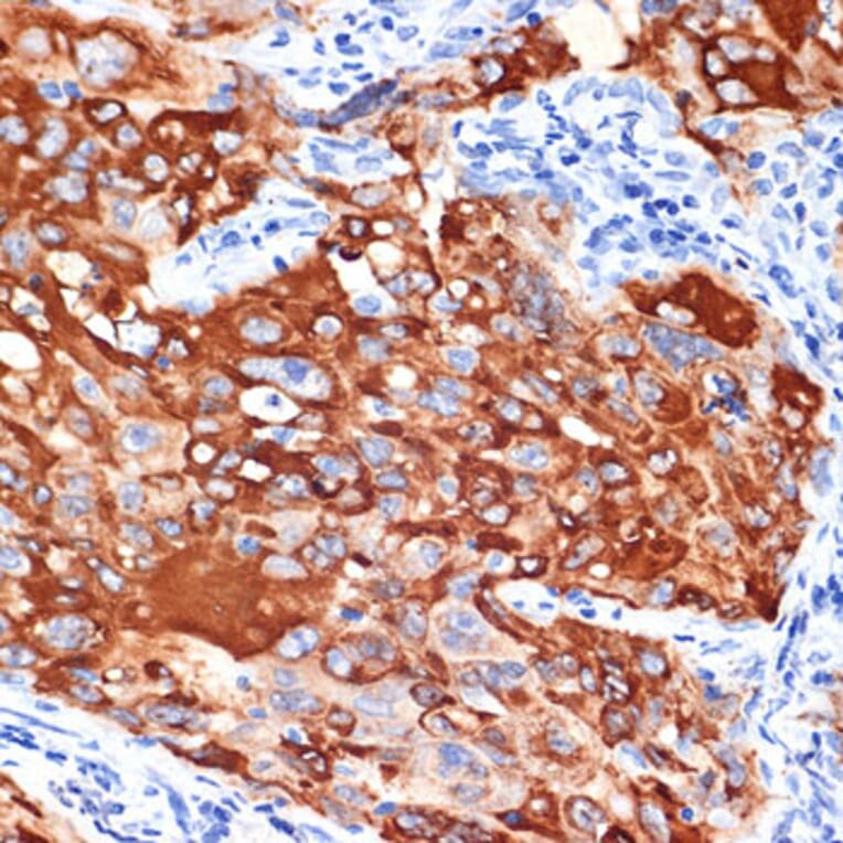 Immunohistochemistry - Anti-IL-13 receptor alpha 1 Antibody (A307315) - Antibodies.com