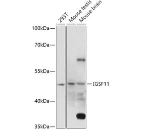 Western Blot - Anti-IGSF11 Antibody (A307316) - Antibodies.com