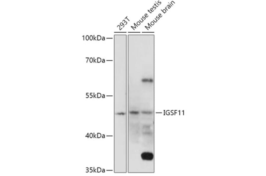Western Blot - Anti-IGSF11 Antibody (A307316) - Antibodies.com