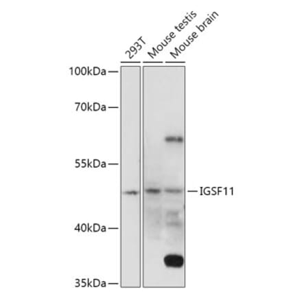 Western Blot - Anti-IGSF11 Antibody (A307316) - Antibodies.com