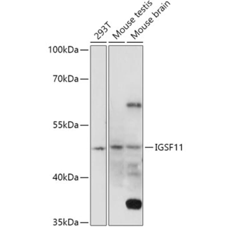 Western Blot - Anti-IGSF11 Antibody (A307316) - Antibodies.com