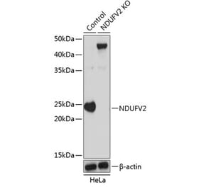 Western Blot - Anti-NDUFV2 Antibody (A307317) - Antibodies.com