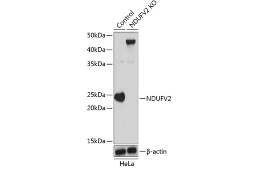 Western Blot - Anti-NDUFV2 Antibody (A307317) - Antibodies.com