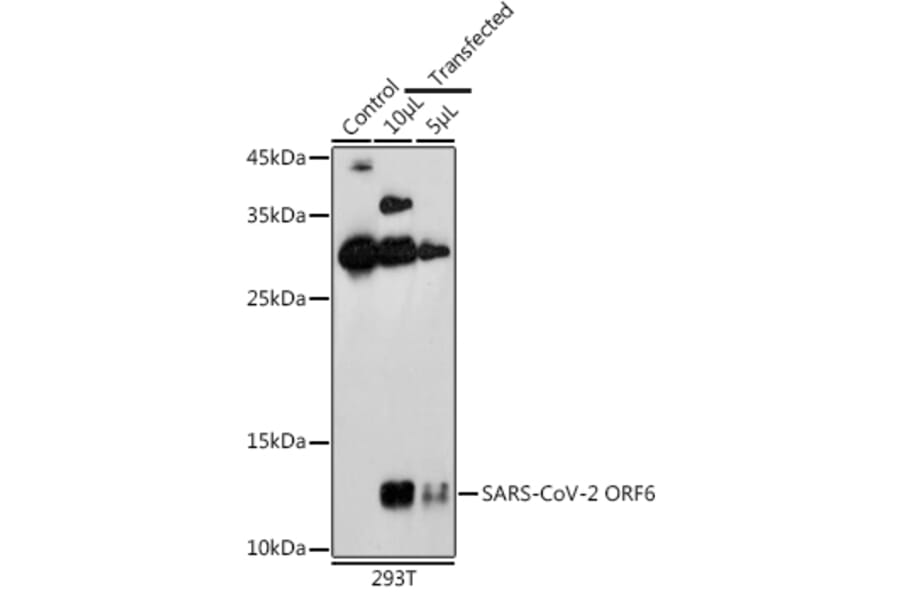 Western Blot - Anti-SARS-CoV2 ORF6 Antibody (A307318) - Antibodies.com