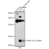 Western Blot - Anti-SARS-CoV2 ORF6 Antibody (A307318) - Antibodies.com
