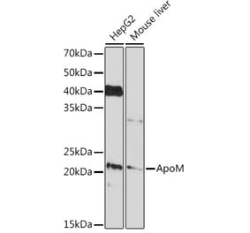 Western Blot - Anti-Apo-M Antibody [ARC1210] (A307319) - Antibodies.com