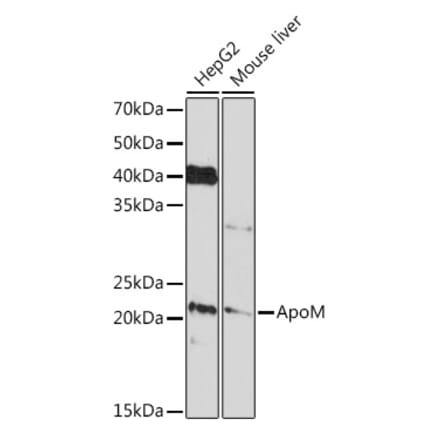 Western Blot - Anti-Apo-M Antibody [ARC1210] (A307319) - Antibodies.com