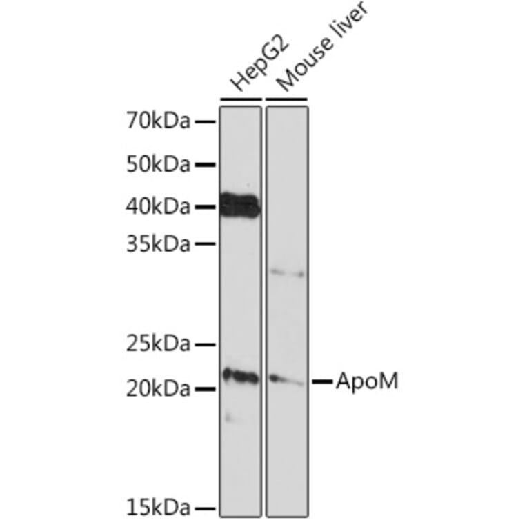Western Blot - Anti-Apo-M Antibody [ARC1210] (A307319) - Antibodies.com