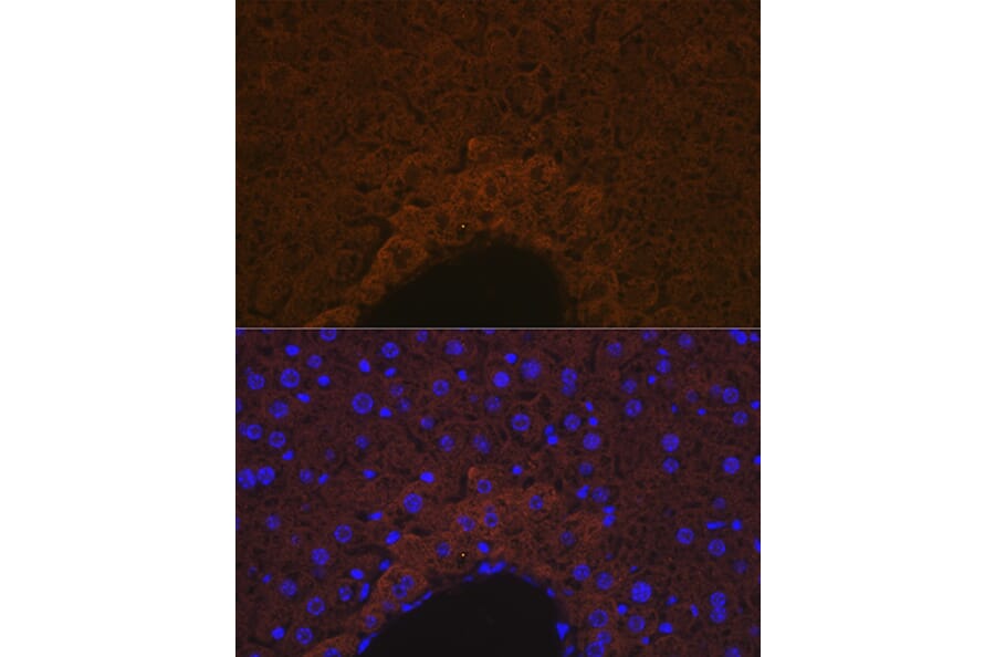 Immunofluorescence - Anti-Apo-M Antibody [ARC1210] (A307319) - Antibodies.com