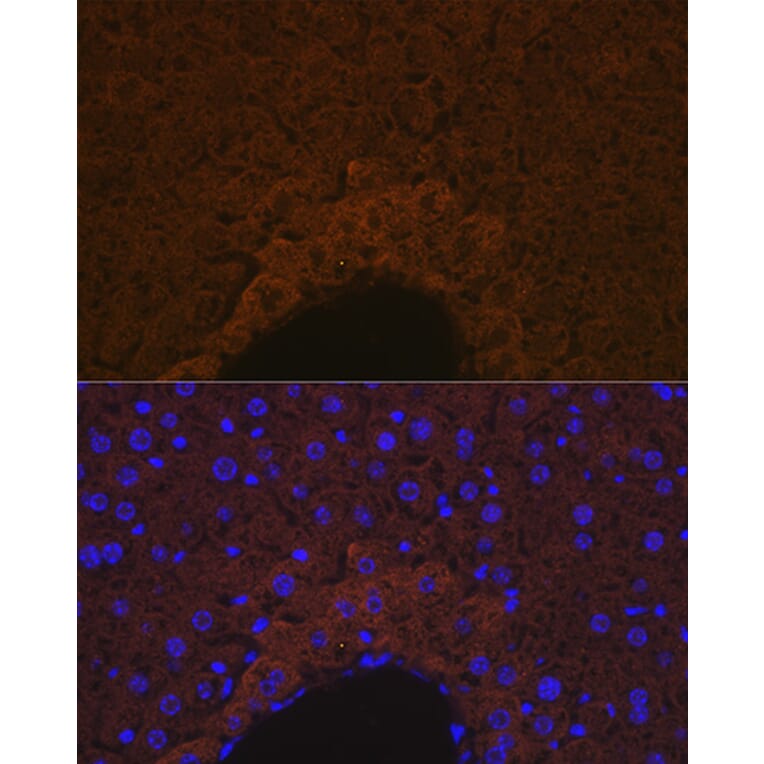 Immunofluorescence - Anti-Apo-M Antibody [ARC1210] (A307319) - Antibodies.com