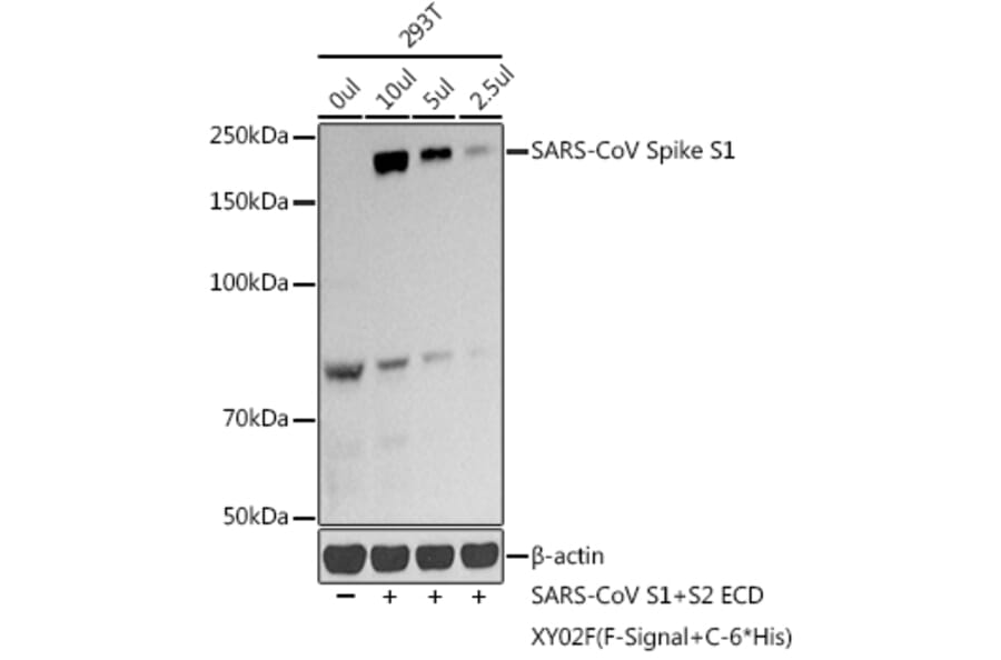 Western Blot - Anti-SARS-CoV2 Spike Glycoprotein S1 Antibody (A307320) - Antibodies.com