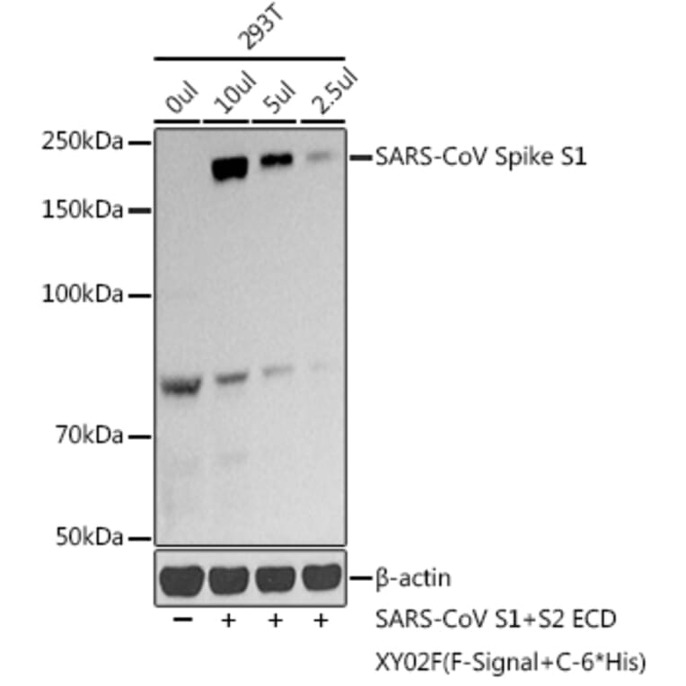 Western Blot - Anti-SARS-CoV2 Spike Glycoprotein S1 Antibody (A307320) - Antibodies.com