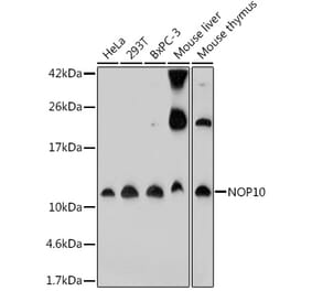 Western Blot - Anti-NOP10 Antibody (A307322) - Antibodies.com