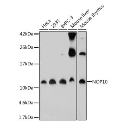 Western Blot - Anti-NOP10 Antibody (A307322) - Antibodies.com