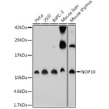 Western Blot - Anti-NOP10 Antibody (A307322) - Antibodies.com