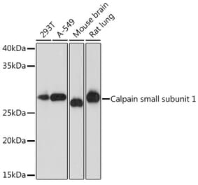 Western Blot - Anti-Calpain small subunit 1 Antibody [ARC1326] (A307324) - Antibodies.com