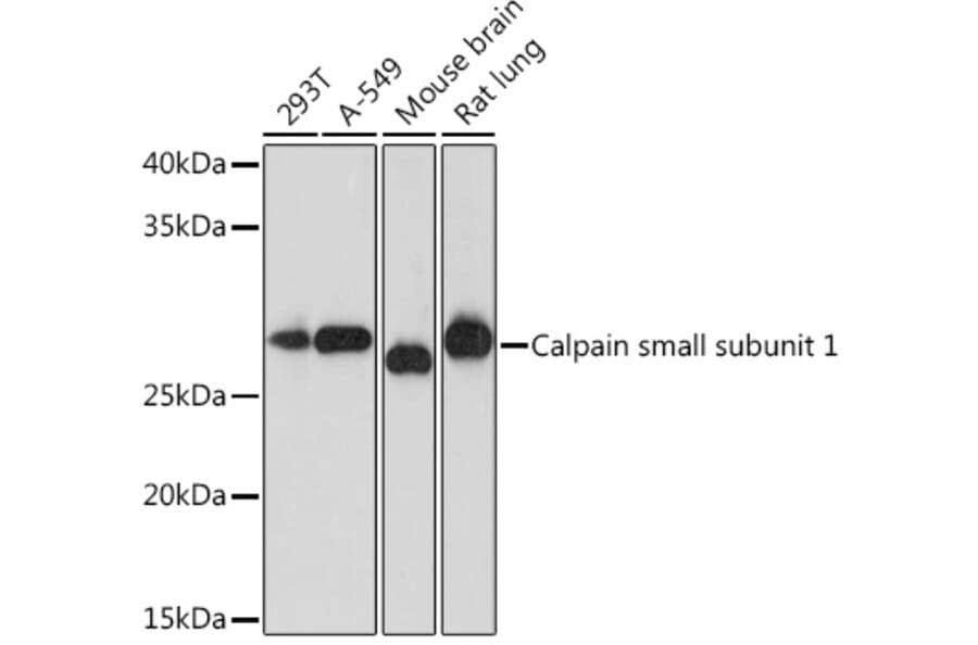 Western Blot - Anti-Calpain small subunit 1 Antibody [ARC1326] (A307324) - Antibodies.com