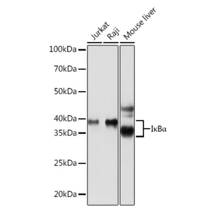 Western Blot - Anti-IKB alpha Antibody [ARC0194] (A307325) - Antibodies.com