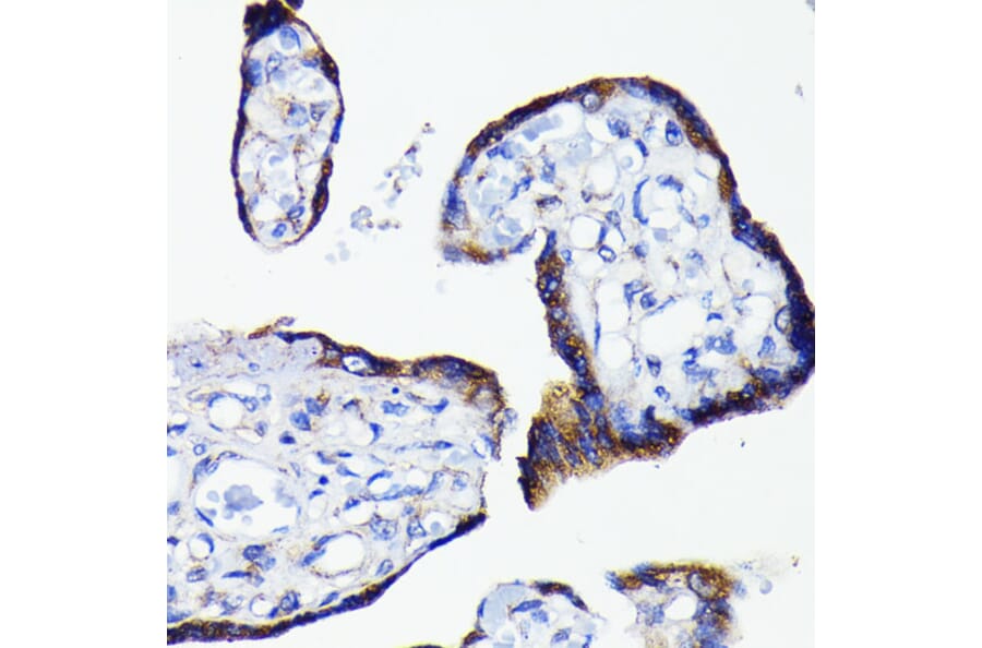 Immunohistochemistry - Anti-Bad Antibody [ARC0074] (A307327) - Antibodies.com