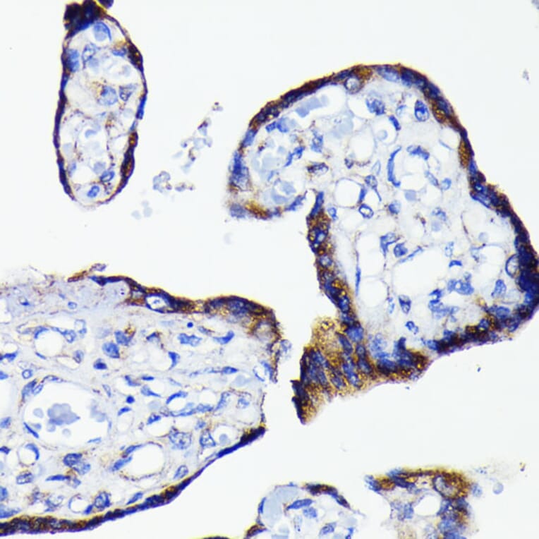 Immunohistochemistry - Anti-Bad Antibody [ARC0074] (A307327) - Antibodies.com