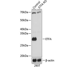 Western Blot - Anti-ETFA Antibody (A307328) - Antibodies.com