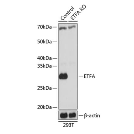 Western Blot - Anti-ETFA Antibody (A307328) - Antibodies.com