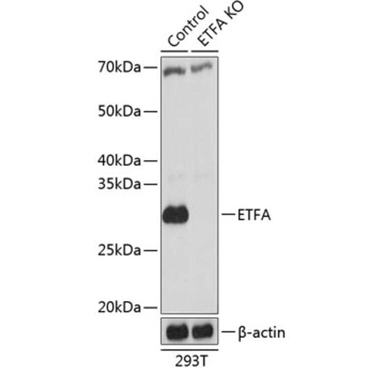 Western Blot - Anti-ETFA Antibody (A307328) - Antibodies.com