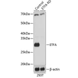 Western Blot - Anti-ETFA Antibody (A307328) - Antibodies.com