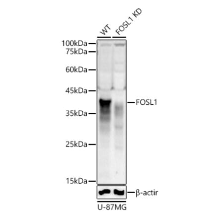 Western Blot - Anti-FRA1 Antibody (A307329) - Antibodies.com