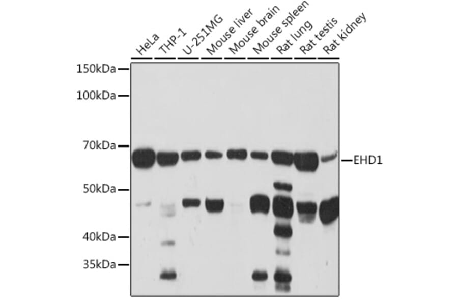 Western Blot - Anti-EHD1 Antibody [ARC2015] (A307331) - Antibodies.com
