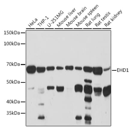 Western Blot - Anti-EHD1 Antibody [ARC2015] (A307331) - Antibodies.com