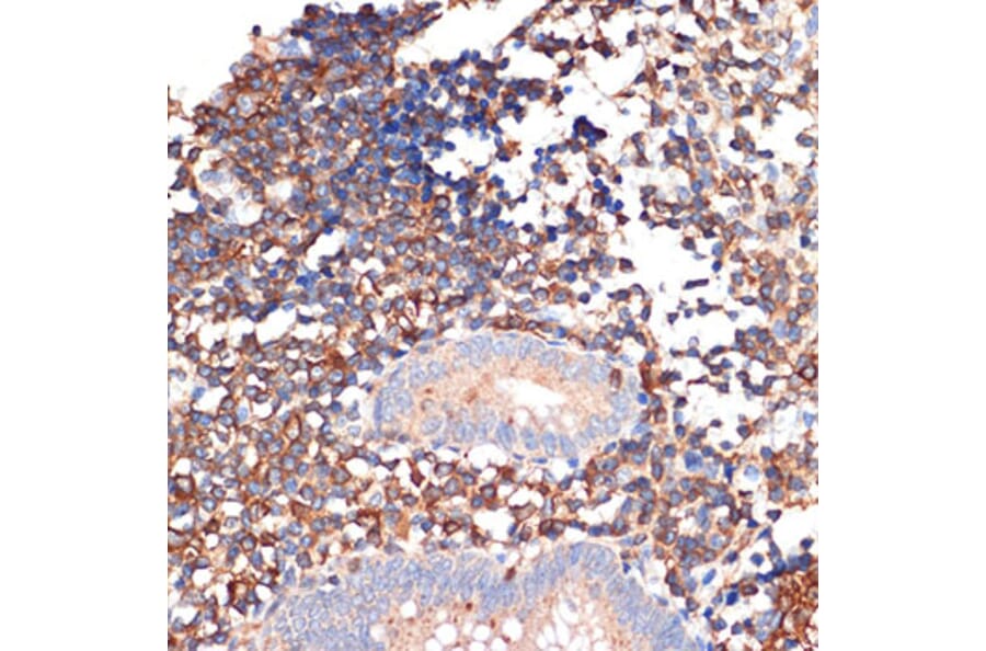 Immunohistochemistry - Anti-EHD1 Antibody [ARC2015] (A307331) - Antibodies.com