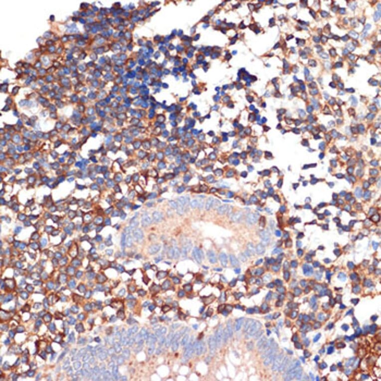 Immunohistochemistry - Anti-EHD1 Antibody [ARC2015] (A307331) - Antibodies.com