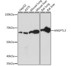 Western Blot - Anti-ANGPTL3 Antibody [ARC1214] (A307333) - Antibodies.com