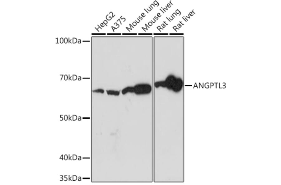 Western Blot - Anti-ANGPTL3 Antibody [ARC1214] (A307333) - Antibodies.com