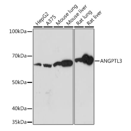Western Blot - Anti-ANGPTL3 Antibody [ARC1214] (A307333) - Antibodies.com