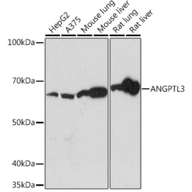 Western Blot - Anti-ANGPTL3 Antibody [ARC1214] (A307333) - Antibodies.com