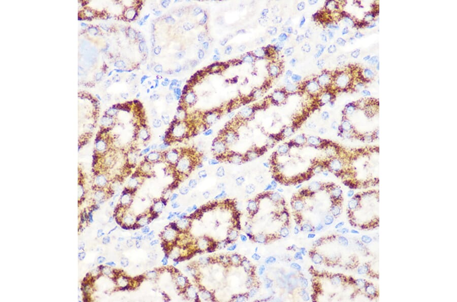 Immunohistochemistry - Anti-ANGPTL3 Antibody [ARC1214] (A307333) - Antibodies.com
