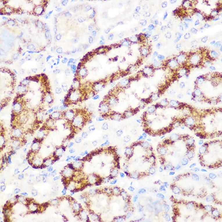 Immunohistochemistry - Anti-ANGPTL3 Antibody [ARC1214] (A307333) - Antibodies.com